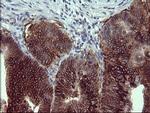 EPCAM Antibody in Immunohistochemistry (Paraffin) (IHC (P))