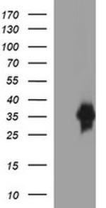 EPCAM Antibody in Western Blot (WB)