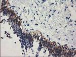 EPM2AIP1 Antibody in Immunohistochemistry (Paraffin) (IHC (P))