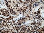 EPM2AIP1 Antibody in Immunohistochemistry (Paraffin) (IHC (P))