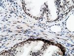 EPM2AIP1 Antibody in Immunohistochemistry (Paraffin) (IHC (P))