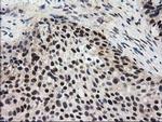 EPM2AIP1 Antibody in Immunohistochemistry (Paraffin) (IHC (P))