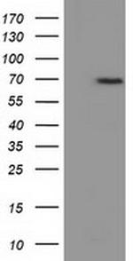 EPM2AIP1 Antibody in Western Blot (WB)