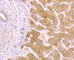 Alpha-1 acid glycoprotein Antibody in Immunohistochemistry (Paraffin) (IHC (P))