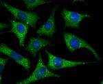 Apolipoprotein A1 Antibody in Immunocytochemistry (ICC/IF)