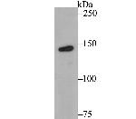 Tyk2 Antibody in Western Blot (WB)