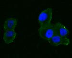 EPHA2 Antibody in Immunocytochemistry (ICC/IF)