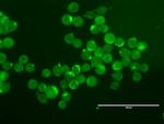 ERBB2 Antibody in Immunocytochemistry (ICC/IF)