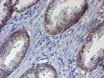 ERBB2 Antibody in Immunohistochemistry (Paraffin) (IHC (P))