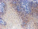 ERBB2 Antibody in Immunohistochemistry (Paraffin) (IHC (P))