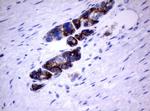 ERBB2 Antibody in Immunohistochemistry (Paraffin) (IHC (P))