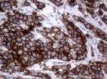 ERBB2 Antibody in Immunohistochemistry (Paraffin) (IHC (P))