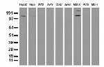 ERBB2 Antibody in Western Blot (WB)