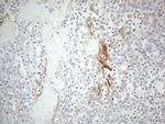 ERBB3 Antibody in Immunohistochemistry (Paraffin) (IHC (P))