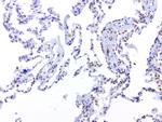 ERCC1 Antibody in Immunohistochemistry (Paraffin) (IHC (P))