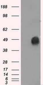 ERCC1 Antibody in Western Blot (WB)