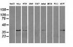 ERCC1 Antibody in Western Blot (WB)