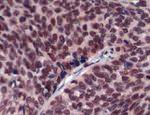 ERCC1 Antibody in Immunohistochemistry (IHC)