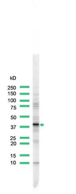 ERCC1 Antibody in Western Blot (WB)