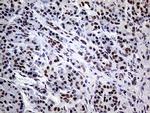 ERCC3 Antibody in Immunohistochemistry (Paraffin) (IHC (P))