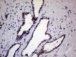 ERCC3 Antibody in Immunohistochemistry (Paraffin) (IHC (P))