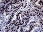 ERCC3 Antibody in Immunohistochemistry (Paraffin) (IHC (P))