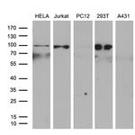 ERCC3 Antibody in Western Blot (WB)