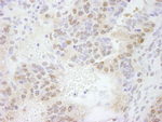 ERF Antibody in Immunohistochemistry (IHC)