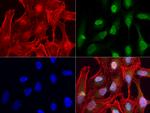 ERG Antibody in Immunocytochemistry (ICC/IF)