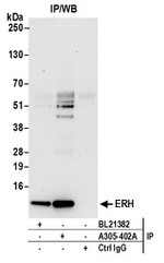 ERH Antibody in Immunoprecipitation (IP)