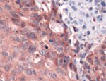 ERK1 Antibody in Immunohistochemistry (IHC)