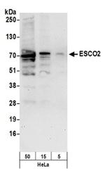 ESCO2 Antibody in Western Blot (WB)