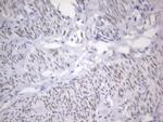 ESR1 Antibody in Immunohistochemistry (Paraffin) (IHC (P))