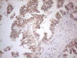 ESR1 Antibody in Immunohistochemistry (Paraffin) (IHC (P))