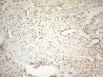 ESR1 Antibody in Immunohistochemistry (Paraffin) (IHC (P))