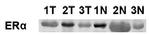 ESR1 Antibody in Western Blot (WB)