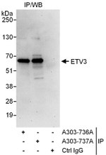 ETV3 Antibody in Immunoprecipitation (IP)