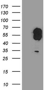 EVX1 Antibody in Western Blot (WB)