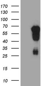 EVX1 Antibody in Western Blot (WB)