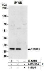EXOSC1 Antibody in Western Blot (WB)
