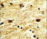 EXOSC8 Antibody in Immunohistochemistry (IHC)