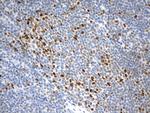 EZH2 Antibody in Immunohistochemistry (Paraffin) (IHC (P))