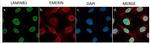 Emerin Antibody in Immunocytochemistry (ICC/IF)