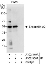 Endophilin A2 Antibody in Immunoprecipitation (IP)