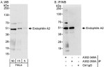 Endophilin A2 Antibody in Western Blot (WB)