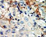 EphA3 Antibody in Immunohistochemistry (IHC)