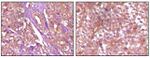 EphB4 Antibody in Immunohistochemistry (Paraffin) (IHC (P))