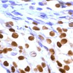 Estrogen Receptor alpha Antibody in Immunohistochemistry (IHC)