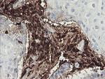 F13A1 Antibody in Immunohistochemistry (Paraffin) (IHC (P))