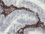 F13A1 Antibody in Immunohistochemistry (Paraffin) (IHC (P))